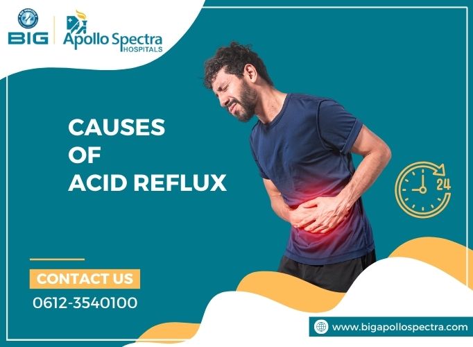 Causes of Acid Reflux â€“ How to Prevent Heartburn & its Symptoms